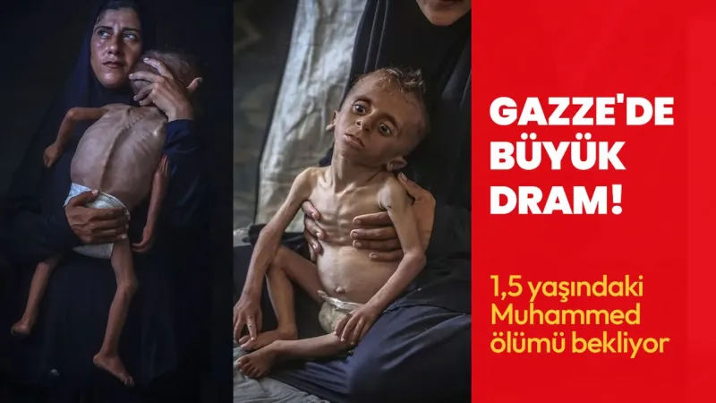 Gazze'de büyük dram! 1,5 yaşındaki çocuk ölüm tehlikesiyle karşı karşıya