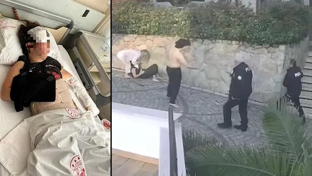 Ordu'da Kan Donduran Olay! Komşu Kavgası Hastanede Bitti