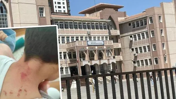 Şanlıurfa'da Öğretmen Dehşeti! 10 Yaşındaki Öğrenciyi Dövdü